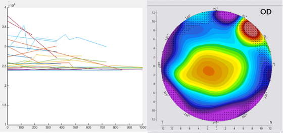 New method for the analysis of corneal biomechanics in keratoconus