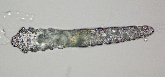 Ο ρόλος των Demodex στην ξηροφθαλμία