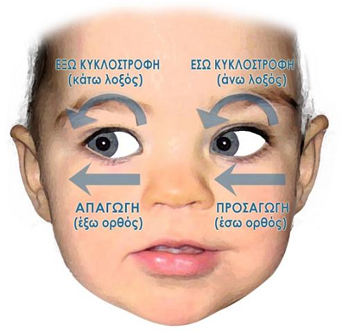 Αλλήθωρα μάτια: Συμπτώματα και θεραπείες - Με Υγεία